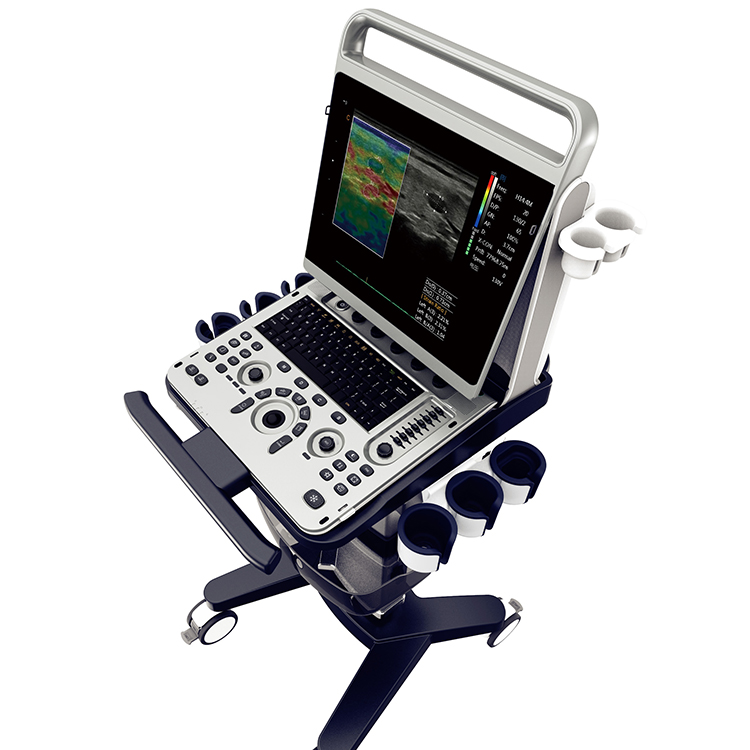 Fábrica Chison Ebit 50 Equipos De Ultrasonido Médico 3D 4D Sistema de Doppler de Color Con Sonda Convexa