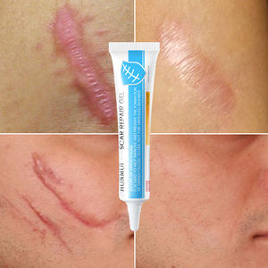 OEM ODM Private Label Bauch narben entfernungs creme mit Silikonentferner-Gel-Dehnung streifen creme für die Behandlung von Gesichts bauch narben - Product Image 1