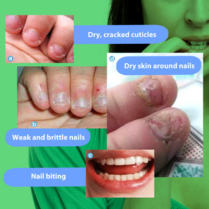 <span class=keywords><strong>Vernis</strong></span> à ongles de haute qualité OEM/ODM, formule douce, nourrit en profondeur, répare, améliore les ongles abîmés et anti-morsures - Product Image 3