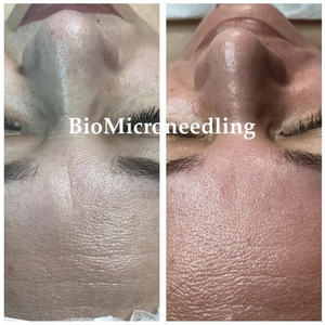 Salon Custom ized/Private Logo Verfügbar Spong illa Spicules Haut Peeling Akne Pigmentierung Massage Verwenden Sie natürliche nicht chemische Säure - Product Image 4