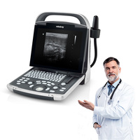 Ecógrafo Veterinario Mindray DP-30, Instrumento de Ultrasonido Veterinario Digital Portátil en Blanco y Negro para Uso General Básico con Sonda Convexa