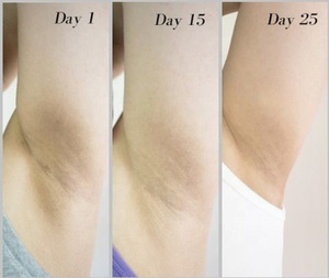 निजी लेबल अंतरंग त्वचा Whitening जेल चमकती शरीर ब्लीच क्रीम, योनि/गुदा के लिए विरंजन-सुरक्षित अंतरंग - Product Image 2