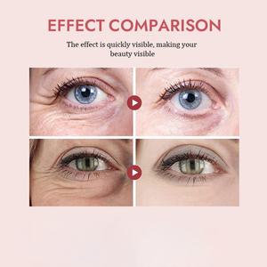 Crema Contorno de Ojos con ADN de Salmón PDRN para Venta al por Mayor y Personalización - Elimina Arrugas y Ojeras - Product Image 5