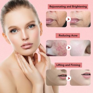 Masajeador <span class=keywords><strong>Facial</strong></span> para el Cuidado de la Piel, Rejuvenecimiento <span class=keywords><strong>Facial</strong></span>, Dispositivo Antienvejecimiento y Lifting - Product Image 4