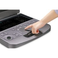 Échographe portable avec écran haute résolution de 15,6 pouces, 128 canaux physiques, sonde linéaire pour les examens vasculaires