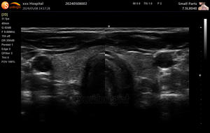 医療ポータブルPWカラー超音波スキャンマシン - Product Image 5