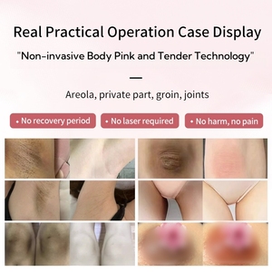 Intimate Area Nipple Whitening <strong>Anal</strong> Bleaching Pink Lip Nipple Direct From Cosmetics Factory - Product Image 6