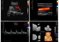 Système d'échographie médicale vétérinaire en gros, échographe cardiaque, scanner d'échographie vétérinaire