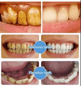 Dentifrice sans fluorure avec 7,5 % d'hydroxyapatite nano, réparation de l'émail, blanchiment, soin des dents sensibles, menthe, 120 g - Product Image 3