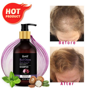Shampooing à l'oignon rouge entièrement naturel OEM Anti-chute et amincissement des cheveux Shampooing à l'eau de riz à la biotine pour la repousse des cheveux - Product Image 4