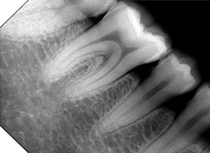 Thiết bị nha khoa cảm biến kỹ thuật số x Ray máy/nha khoa intraoral Hệ thống hình ảnh rayos Vet x Ray đơn vị - Product Image 5