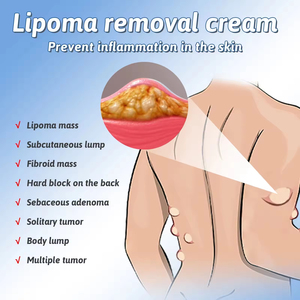 Spray para Lipomas y Celulitis de 50 ml con Hierbas Naturales para Alivio del Dolor, Uso Corporal, 2 Años de Duración - Product Image 3