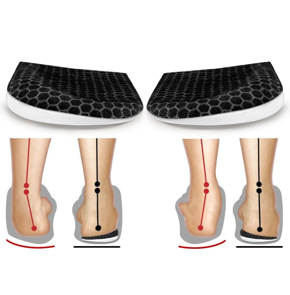 Over Pronation Insoles Supination Foot Insoles Insoles Over
