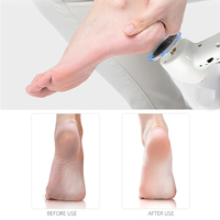 IBelieve Nail Supplie Appareil professionnel de pédicure, machine de soin des pieds, éliminateur de callosités électrique sans fil rechargeable puissant