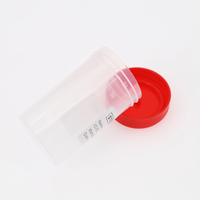 Taza de plástico desechable para prueba de pacientes, contenedor de orina, 30ml, 40ml, 60ml