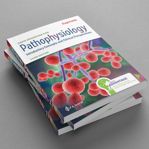Davis Advantage para Patofisiología, 3.ª Edición, Libro de Texto Médico de Tapa Blanda, Encuadernación Perfecta, Impresión de Libros Personalizada - Product Image 5