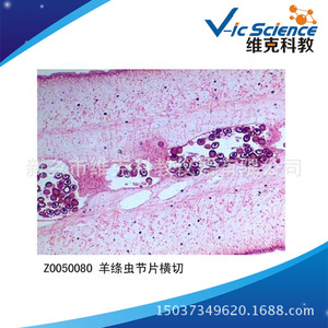 Transverse section of a sheep tapeworm segment; animal, phylum Platyhelminthes; animal and plant section specimen; <b>microscope</b> - Product Image 5
