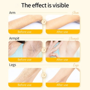 Private label capelli degli uomini di tutto il <span class=keywords><strong>corpo</strong></span> di rimozione permanente dei capelli <span class=keywords><strong>crema</strong></span> di rimozione organico <span class=keywords><strong>spray</strong></span> per uomo e donna - Product Image 5