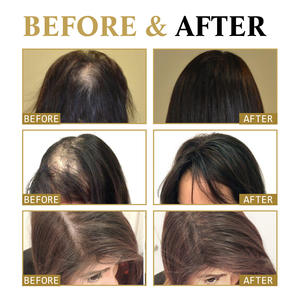 Esencia Capilar Roll-on <span class=keywords><strong>West</strong></span>&Month de 20 ml con Logotipo Personalizado, Reduce la Caída del Cabello, Fortalece y Oscurece, Suero de Masaje - Product Image 2