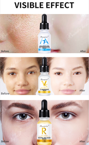 Set de Suero Antienvejecimiento con Retinal para el Cuidado de la Piel al por Mayor, Blanqueador, Reafirmante, Elimina Manchas Oscuras - Product Image 5