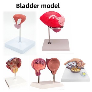 Modelo Anatómico de Riñón con Glándulas Adrenales Ampliadas, Riñones Patológicos, Anatomía Visceral Humana, Material PVC, MAXCARE MAC-L27 - Product Image 4