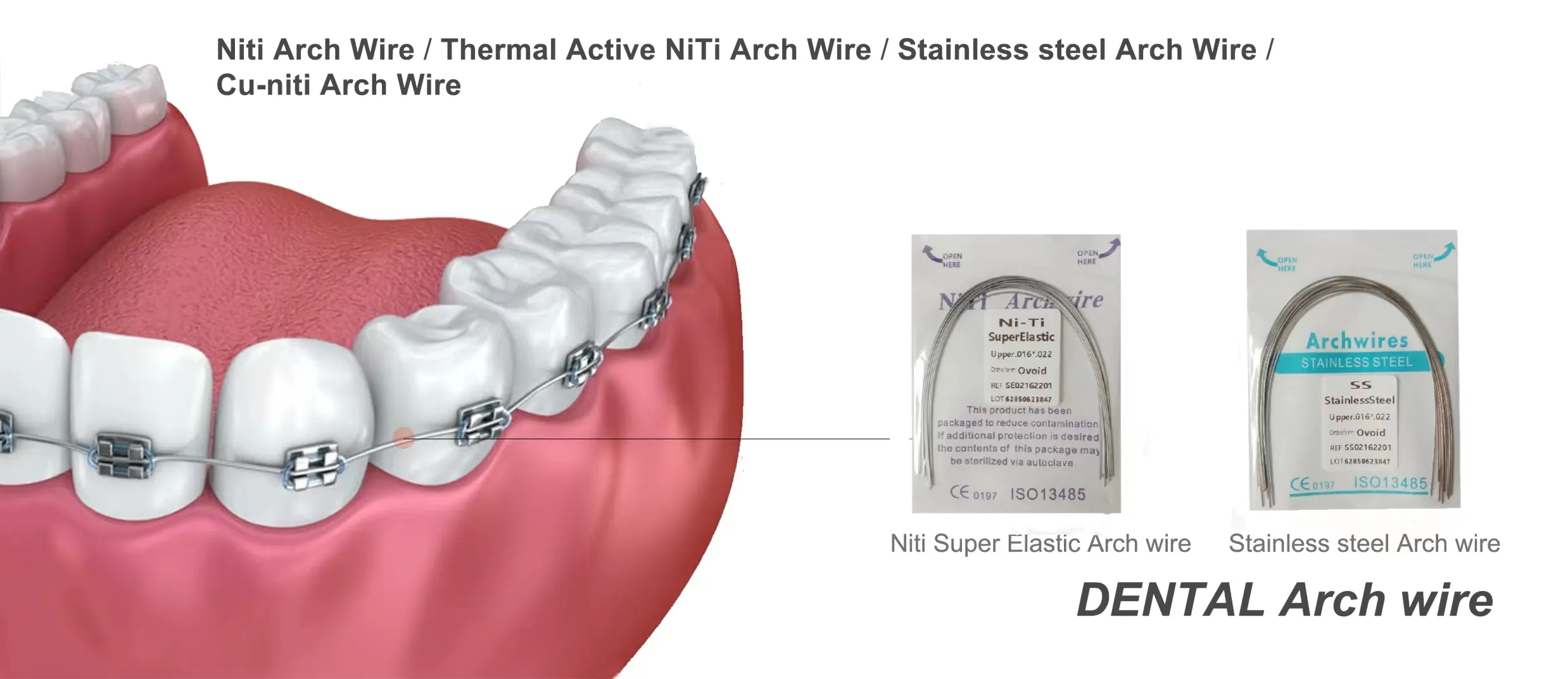 ligature wire orthodontics