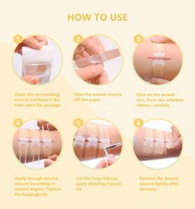 Dispositif de Fermeture de Plaies à Fermeture Éclair Sans Douleur pour Urgences, Vente en Gros Usine, Pansement à Fermeture Éclair Désinfectant pour Fermetures de Plaies - Product Image 3