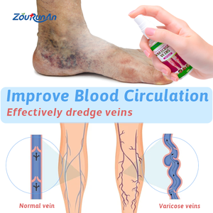 ZouRunAn Aerosol para <span class=keywords><strong>venas</strong></span> varicosas Vasculitis Flebitis <span class=keywords><strong>Piernas</strong></span> <span class=keywords><strong>de</strong></span> araña Calmante Vasos sanguíneos Abultado Enrojecimiento Pierna Cuidado corporal Aerosol para <span class=keywords><strong>venas</strong></span> - Product Image 3