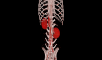 Système de tomodensitométrie numérique professionnelle EURVET pour diagnostic médical, 16, 24, 32, 64 coupes, scanner CT médical