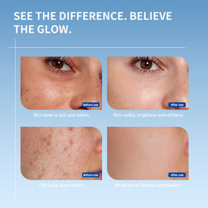 <span class=keywords><strong>Extrait</strong></span> <span class=keywords><strong>de</strong></span> Pépins <span class=keywords><strong>de</strong></span> <span class=keywords><strong>Pamplemousse</strong></span> Personnalisé pour Sérum Visage Éclaircissant à la Niacinamide, à l'Acide Hyaluronique <span class=keywords><strong>et</strong></span> à la <span class=keywords><strong>Vitamine</strong></span> E 30ml Naturel - Product Image 5