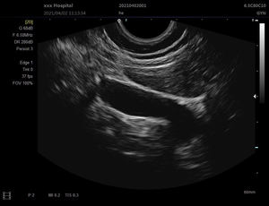 Mesin <span class=keywords><strong>Ultrasound</strong></span> SS-9B untuk dokter hewan/manusia Sonostar mesin <span class=keywords><strong>Ultrasound</strong></span> Laptop portabel - Product Image 3