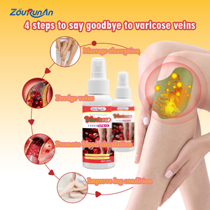 Spray <span class=keywords><strong>para</strong></span> el Cuidado de <span class=keywords><strong>las</strong></span> Venas Varicosas ZouRunAn 30ml, Masaje de Piernas, Circulación, Bienestar Externo, Alivio del Dolor, Alcanfor - Product Image 1