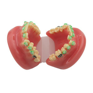 Modelo de Demostración de Ortodoncia para Educación Dental con 28 Piezas de Dientes y Brackets de Cerámica - Product Image 4