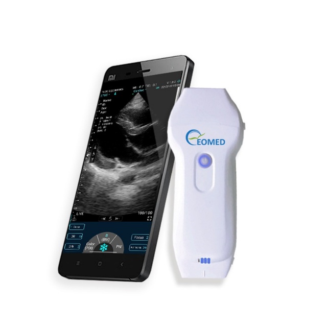 EOMED Handheld Wireless Color Doppler Ultrasound Diagnostic Machine Cardiac/Linear Dual Probe 128 Elements Multi-Mode Display