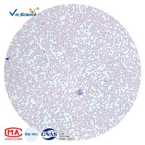 Accesorios para Microscopio a <span class=keywords><strong>Precio</strong></span> Competitivo, Portaobjetos Preparados de Hematología, Portaobjetos de Hematología para Educación, Portaobjetos Preparados para Microscopio - Product Image 2