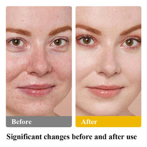 Private Label 100% Grass Fed Tallow Skin Whitening <strong>Wrinkle</strong> <strong>Paste</strong> Organic Beef Tallow Moisturizer for All Skin Night Use - Product Image 6