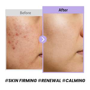 Crème au collagène d'escargot noir 50ml, hydratant visage coréen aux peptides, hydratation légère pour tous types de peau - Product Image 4