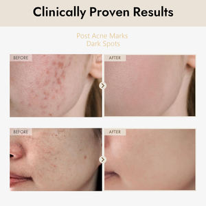 Siero di riso 2% alfa arbutina idratante disomogeneo rimozione del tono della pelle macchie scure siero per la cura del viso coreano - Product Image 2