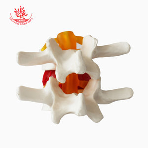 FRT039, un modelo ampliado de la columna lumbar, se utiliza para la enseñanza y demostración de la hernia de disco lumbar. - Product Image 2