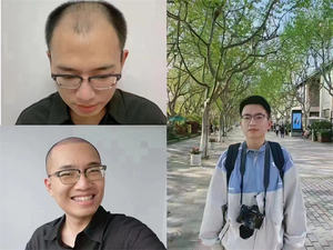 Suero para el Cabello de Marca Privada G, Solución para el Cuero Cabelludo Dañado, Nutre las Raíces, Crecimiento Rápido, Anticaída - Product Image 6