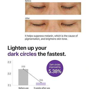 Someby Retinol Intense Eye Cream 30ml Antiarrugas Para Todo Tipo de Piel - Product Image 2