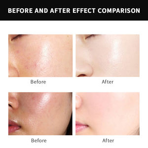 Hot Selling Celebrity Anti-Aging Serum Hyaluronzuur & Peptide Complexe Rimpelreparatie Verstevigende Oem Odm Service - Product Image 6