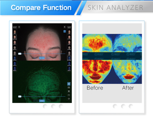 Analizador Facial 3D con IA MC88 para Análisis de Arrugas, Pigmentación y Acné, Compatible con Pantalla iPad, Enchufe EU/US/JP, 1 Año de Garantía - Product Image 2