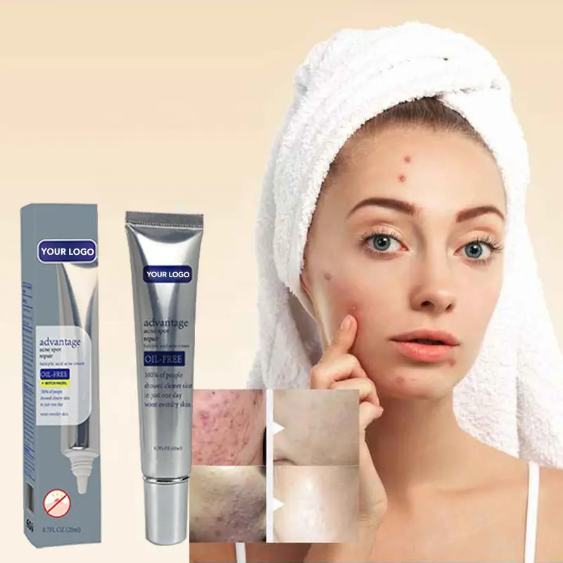 Alta Qualidade Atacado espinha removedor creme tratamento anti acne rosto cicatriz remoção creme acne creme