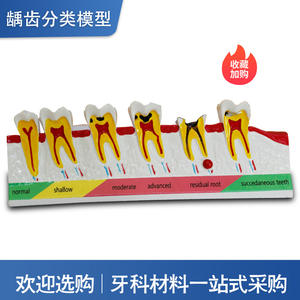 แบบจำลองทางกายวิภาคทางทันตกรรม PVC สำหรับการจำแนกโรคฟันผุและการสอนทางการแพทย์ในช่องปาก - Product Image 3