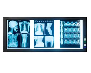 ไฟ LED ส่องแบบ Single Double X-Ray,ไฟส่องดูภาพยนตร์ทางการแพทย์