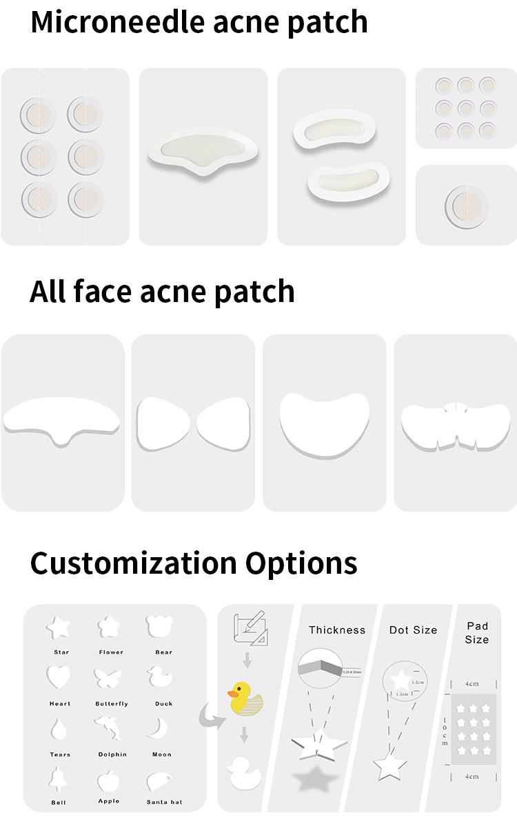 Options de personnalisation