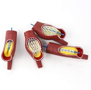 Modelo de <span class=keywords><strong>Stent</strong></span> Vascular Humano KyrenMed, Modelo de Arteria Coronaria, Obstrucción de Vasos Sanguíneos Cardiovasculares, Modelo de Soporte para Bloqueo de Vasos Sanguíneos - Product Image 5