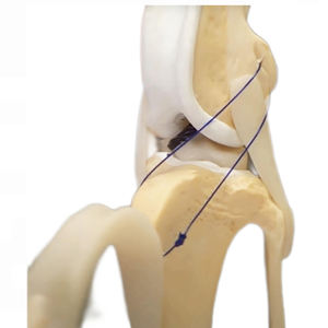 Veterinair orthopedisch instrument voor honden, cruciaal ligament, kunstmatige ligamentimplantaten voor dieren - Product Image 3