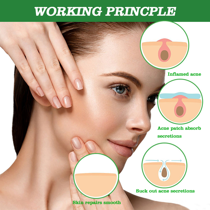 custom waterproof invisible ultra- thin hydrocolloid acne pimple spot patch adhesive blemish patch for acne healing